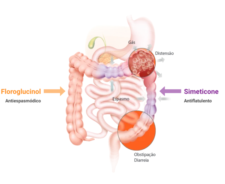 Ilustração do sistema digestivo humano com destaque para gases, distensão e espasmos intestinais; indica Floroglucinol como antiespasmódico e Simeticone como antiflatulento, associados ao alívio de obstipação e diarreia.